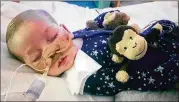  ?? CONTRIBUTE­D BY FAMILY OF CHARLIE GARD ?? Charlie Gard at London’s Great Ormond Street Hospital. The baby, who would be 1 year old on Aug. 4, will soon be taken off life support.