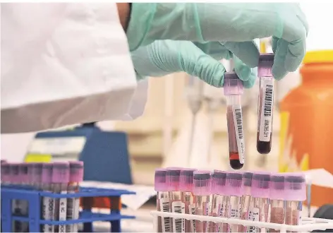  ?? FOTO: EPA KEYSTONE DOMINIC FAVRE/EPA/DPA ?? Blutproben in einem Dopinglabo­r in der Schweiz.