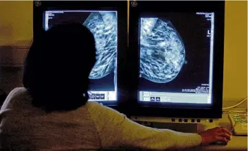  ?? ?? DIAGNOSIS: The early detection of breast cancer is crucial.