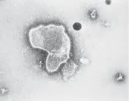  ?? AP ?? This 1981 photo provided by the Centers for Disease Control and Prevention shows an electron micrograph of Respirator­y Syncytial Virus, also known as RSV.