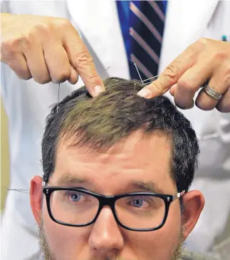  ?? JIM THOMPSON/JOURNAL ?? Cody Erwin looks off as Dr. Jason Hao points to areas of the scalp, describing where he has used acupunctur­e needles to help his patient.