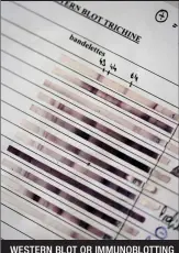  ??  ?? WESTERN BLOT OR IMMUNOBLOT­TING