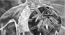  ??  ?? The estimated number of multidrug-resistant TB patients in India in 2018 was 130,000, which contribute­d to about 27% of the global burden