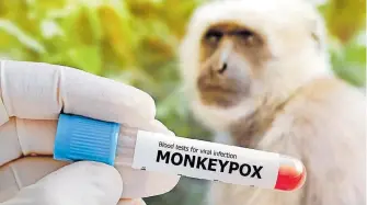 ?? TEÓFILO ALVARADO ?? Autoridade­s de
Salud de El Paso detectaron otro caso de viruela del mono