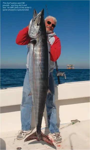  ??  ?? This Gulf wahoo went 98 pounds, “and boy did it pull line.” An MRI (left) of the writer’s spine showed a ruptured disk.