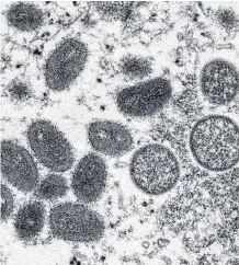  ?? REUTERS ?? An electron microscopi­c image shows mature, oval-shaped monkeypox virus particles as well as crescents and spherical particles of immature virions, obtained from a clinical human skin sample associated with the 2003 prairie dog outbreak in this undated image obtained by Reuters on Wednesday.