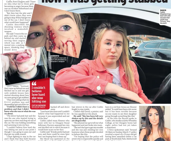  ??  ?? HORRIFIC The student’s nose and lip were left bloodied by attacker’s weapon SCARED SHOCK Caitlin Shepherd has been left with wounds that could scar. Picture: Tony Nicoletti Caitlin battled to stay in car