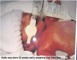  ??  ?? Holly was born 12 weeks early weighing just 2lbs 9oz