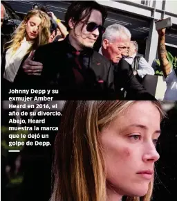  ??  ?? Johnny Depp y su exmujer Amber Heard en 2016, el año de su divorcio. Abajo, Heard muestra la marca que le dejó un golpe de Depp.