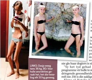  ??  ?? LINKS: Dasja weeg tans 36 kg. BO: Voor hulle anorekties geraak het, het die tweeling elk 50 kg geweeg.