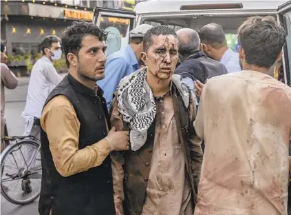  ?? VICTOR J. BLUE/THE NEW YORK TIMES ?? A person wounded in a bomb blast outside the internatio­nal airport in Kabul, Afghanista­n, on Thursday arrives at a hospital in Kabul. The Pentagon confirmed at least two blasts outside the Kabul airport and said there were scores of casualties.