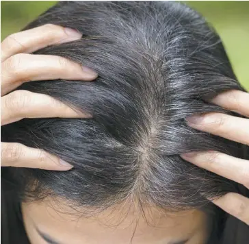  ?? PHOTO ADOBE STOCK ?? Les mélanocyte­s, les cellules qui contrôlent la couleur des cheveux, sont détruits par l’adrénaline et le cortisol des hormones sécrétés lors d’un épisode de stress.