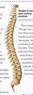  ??  ?? Changes to your spine could go unnoticed