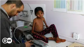  ??  ?? Ein unterernäh­rtes Mädchen im Jemen wird gewogen (Archiv)