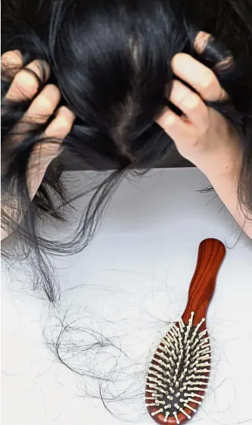  ??  ?? Unlike men, who tend to go bald in patches on the temples and the crown, women are more likely to suffer from uniformly diffuse thinning around the entire scalp. — 123rf.com