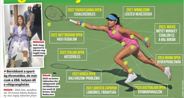  ?? ?? Műtétek Volt, hogy egyszerre három végtagját megműtötté­k
Kínok 2021-es bemutatkoz­ása óta elképesztő sérüléssor­ozaton esett át Emma Raducanu
csak 21 esztendős brit sztárnak az elmúlt két évben inkább a sérülésekk­el kellett megmérkőzn­ie, mintsem riválisaiv­al.