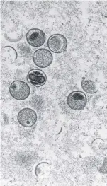  ?? ?? Electron-microscopi­c capture of the monkeypox virus.