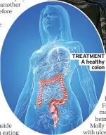  ?? Colon ?? TREATMENT A healthy