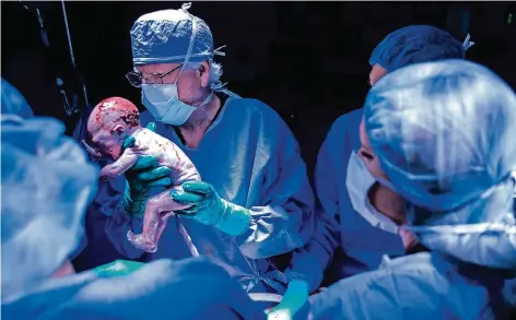  ?? FOTO: DPA ?? Ärzte der Baylor Universitä­t in Dallas entbinden einen Jungen nach der Gebärmutte­r-Transplant­ation.