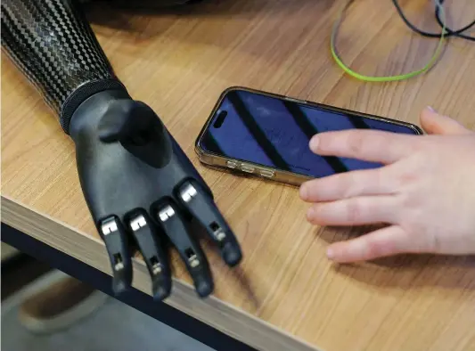  ?? — AFP ?? A bionic prosthetic hand of Valery Kucherenko lies on a table in the workshop of the Protez Foundation in Kyiv on April 3, 2024. On October 19, 2023, Valery was seriously wounded during the battle, as a result of which he was left without both hands. On December 6, 2023, Valery was awarded the Order of the Gold Star and the title of Hero of Ukraine by the country’s president.