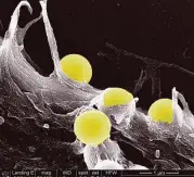  ?? Matthew J. Ware and Biana Godin, Houston Methodist Research Institute ?? One-micron-size yellow particles adhere to a human fibroblast cell. (Fibroblast­s are found in the tumor microenvir­onment.)