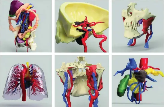  ?? QUIRÓNSALU­D ?? Imágenes digitales de algunos modelos 3D realizados en este hospital madrileño