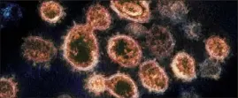  ??  ?? The SARS- CoV- 2 virus, which causes COVID- 19. National Institute of Allergy and Infectious Diseases, NIH