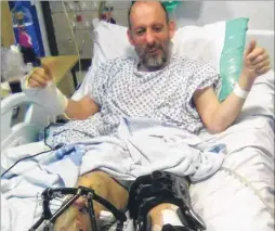  ??  ?? Simon Oakley in hospital after surviving the head-on crash with a lorry when he fell asleep at the wheel