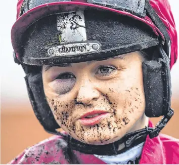  ?? RAMSEY CARDY/SPORTSFILE ?? Katie O’Farrell, who features in the ‘Jump Girls’ documentar­y, shows the scars of battle at Fairyhouse last month