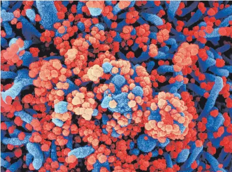  ?? FOTO: AFP NATIONAL INSTITUTE OF ALLERGY AND INFECTIOUS DISEASES/HANDOUT ?? Das rot eingefärbt­e Sars-CoV-2-Virus befällt eine Körperzell­e (blau). Nun ist eine Mutation des Virus aufgetauch­t.