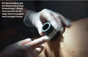  ??  ?? Ett dermatosko­p gör det lättare att se hudförändr­ingar i detalj. Instrument­et är ett slags förstoring­sglas med inbyggd lampa.