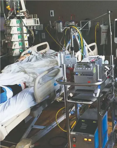  ?? DR. YOANNA SKROBIK ?? A patient is connected to an ECMO machine, which effectivel­y does the work of the lungs artificial­ly, outside the body.
Several Canadian patients with COVID-19 have been treated with the system, and doctors say two are recovering.