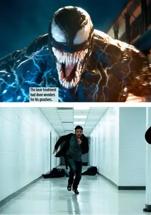  ??  ?? The laser treatment had done wonders for his gnashers. Tom Hardy stars as the very athletic Eddie Brock.