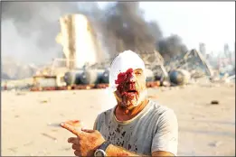  ?? (AP) ?? An injured man walks at the scene of an explosion that hit the seaport in Beirut, Lebanon
on Aug 4.