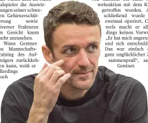  ?? FOTO: DPA ?? Christian Gentner zeigt die Reste seiner Gesichtsve­rletzungen.