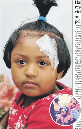  ?? MAIN PICTURE: PAUL MacNAMARA/GUZELIAN. ?? RECOVERING: Noorsadia Akhter, two, who had a lucky escape after she was shot in the head by an airgun pellet. Inset, with her mother, Noor Nahar.