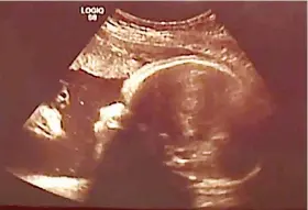  ?? / HUFFINGTON POST ?? ■ JeSuS: Nakita sa gihimo nga ultrasound ang nawong ni Jesus nga nagtan-aw sa bata.