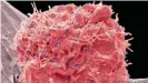  ??  ?? HIV continuous­ly mutates making it extremely difficult for the human body — and vaccine researcher­s — to create the appropriat­e neutralizi­ng antibodies to fight the virus