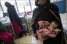  ?? BERNAT ARMANGUE — THE ASSOCIATED PRESS FILE ?? An Afghan woman holds her 5-month-old daughter, Samina, at the malnutriti­on ward of the Indira Gandhi Children’s Hospital in Kabul, Afghanista­n.