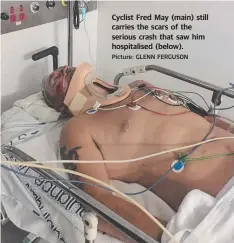  ?? Picture: GLENN FERGUSON ?? Cyclist Fred May (main) still carries the scars of the serious crash that saw him hospitalis­ed (below).
