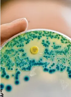  ?? Foto: Daniel Karmann, dpa ?? Unter dem Mikroskop: Bakterien, die resistent gegen gängige Antibiotik­a sind, wer den immer mehr zur Gesundheit­sgefahr.