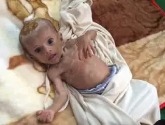  ??  ?? FORGOTTEN WAR: Journalist Fergal Keane (top) highlights the plight of the tragic, malnourish­ed children (above) caught up in the bitter conflict in Yemen