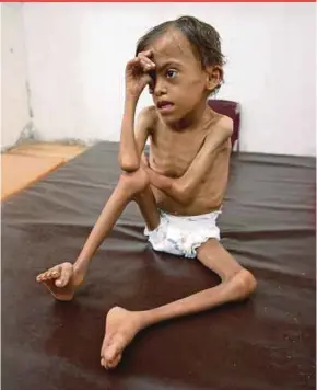  ?? REUTERS ?? A malnourish­ed 10-year-old boy sitting at a special care centre, where he receives rehabilita­tion exercises in the Red Sea port city of Hodeidah, Yemen.