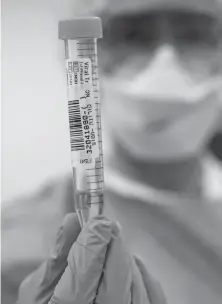  ?? /AFP ?? Un trabajador de la salud sostiene una muestra de un paciente con sospecha de contagio