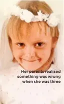  ??  ?? Her parents realised something was wrong when she was three