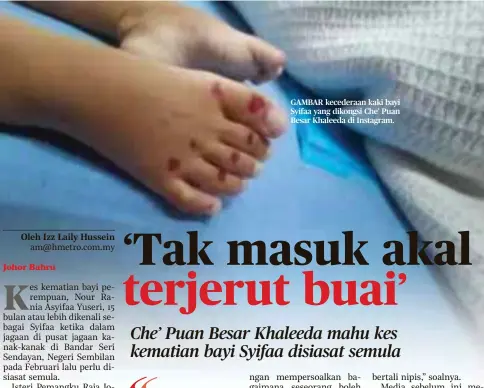  ?? ?? GAMBAR kecederaan kaki bayi Syifaa yang dikongsi Che’ Puan Besar Khaleeda di Instagram.