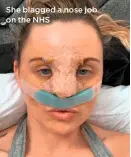  ??  ?? She blagged a nose job on the NHS