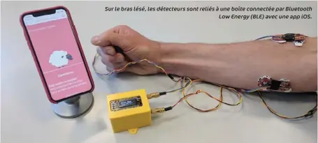  ??  ?? Sur le bras lésé, les détecteurs sont reliés à une boîte connectée par Bluetooth Low Energy ( BLE) avec une app IOS.