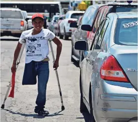  ??  ?? Jovany dijo que la falta de su pierna se debió a una enfermedad de nacimiento