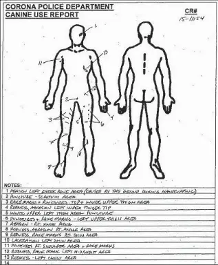  ??  ?? THE POLICE CANINE-USE REPORT shows the injuries Brandon Martin suffered during his apprehensi­on by Corona police. Martin punched and body-slammed the 79-pound dog.